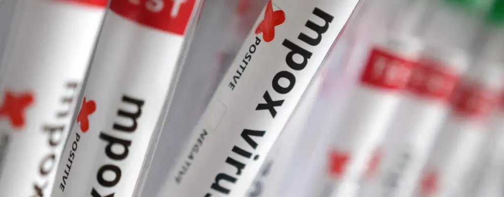 2024-08-20t135720z_630138133_rc2pj9ajc7r8_rtrmadp_3_health-mpox